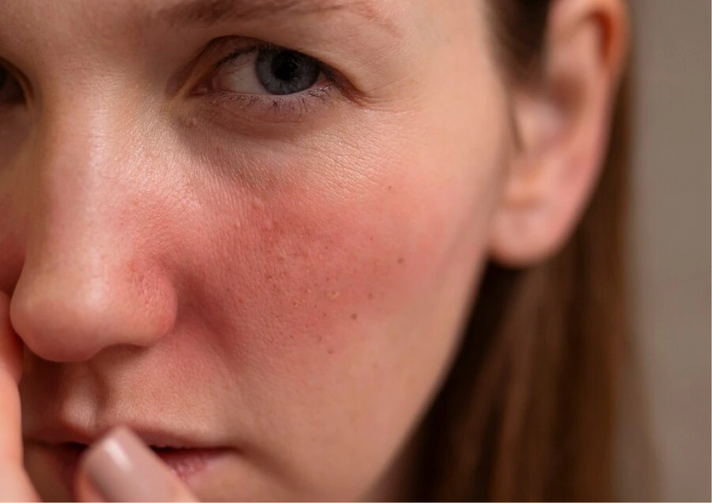 Skin Conditions Banner