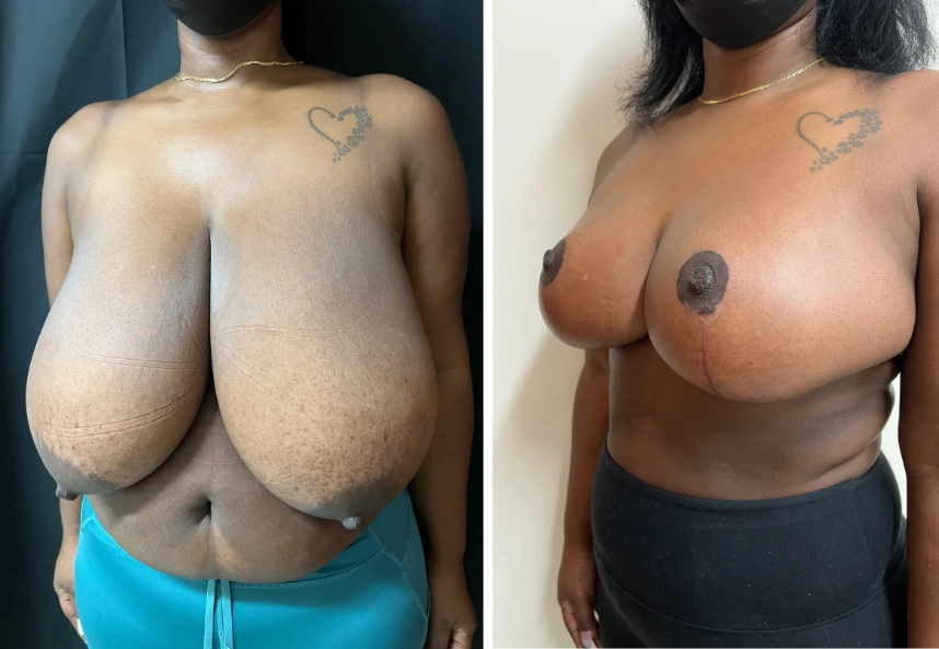 29