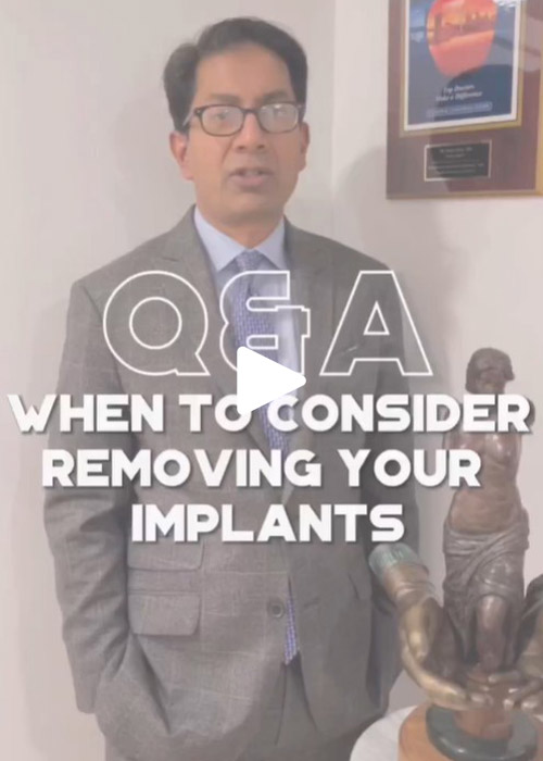 Implant Removal Q&A with Dr. Sabry