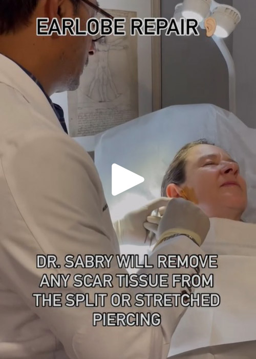 earlobe repair with Dr. Sabry Murray Hill Plastic Surgery