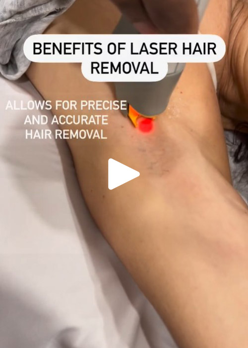 Benefits of laser hair removal at Murray Hill Plastic Surgery NYC