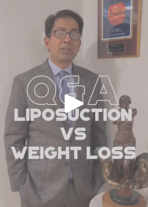 Lipo vs weight loss Q&A with Dr. Sabry