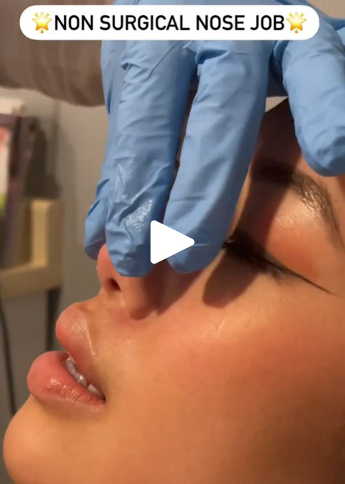 non-surgical nose job technique NYC